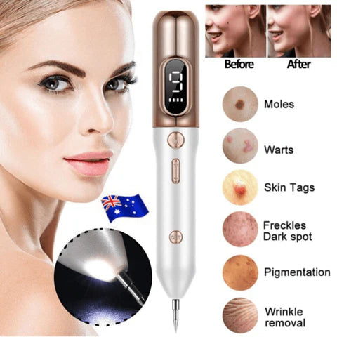 Wildbloom ™ -  Highest Rated Laser Freckle Removal Machine and Skin Tag Remover Pen