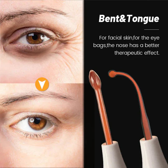 Wildbloom ™ High Frequency Skin Therapy wand 4 in 1