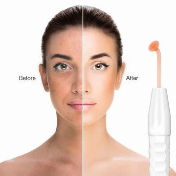 Wildbloom ™ High Frequency Skin Therapy wand 4 in 1